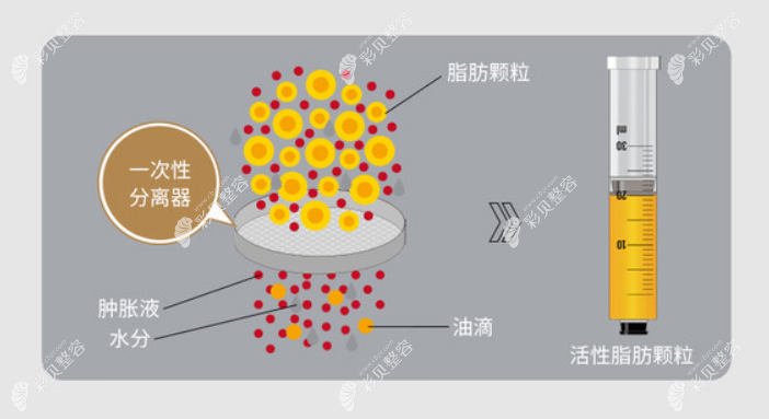 自体脂肪胶和自体脂肪的区别