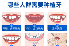 种植牙和真牙感觉一样吗,装完种植牙会不会有异物感