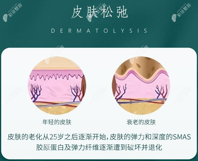 微创悬吊提升术和筋膜悬吊一样吗？哪个的维持时间久