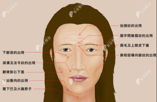 血压高的人能做面部小拉皮手术吗,如果能做术后会有疤痕吗
