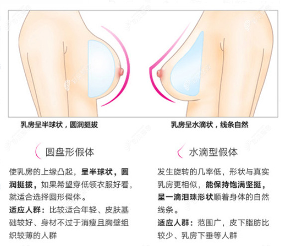 水滴型和圆盘型假体该怎么选