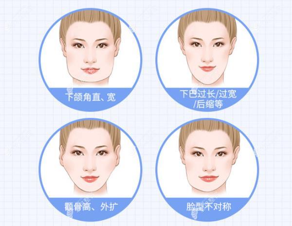 上海郑志雄和吉玟锡谁磨骨做得好?我颧骨高,想做颧骨内推