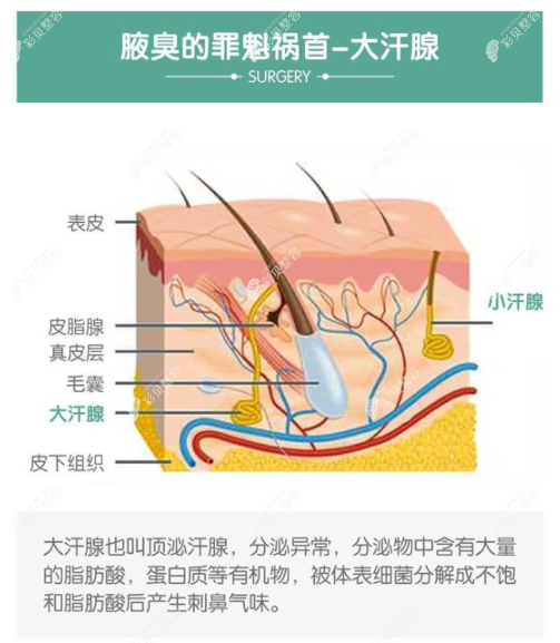 清新微波治狐臭价格