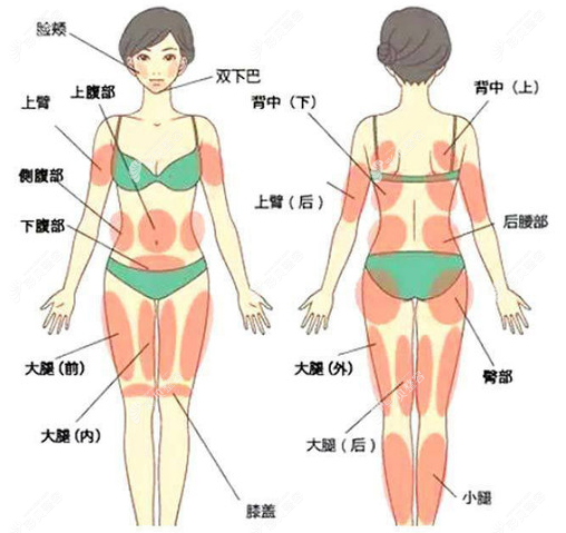 梁晓健医生可吸脂的部位