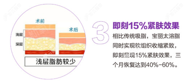 深圳美莱做钻石精 雕的优势
