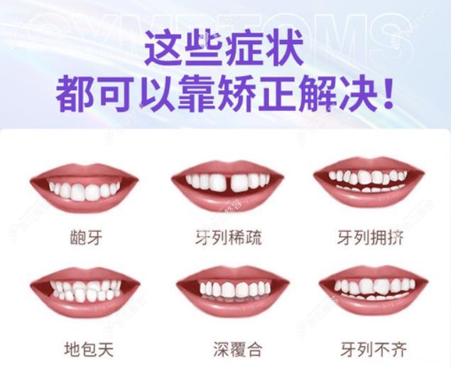 eta儿童早期矫治器可以改善哪些症状