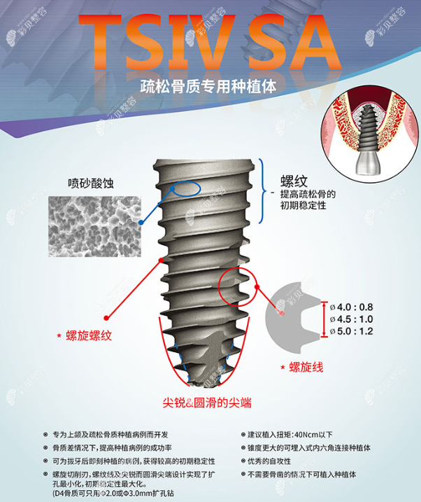 奥齿泰TSIV SA植体适应症介绍