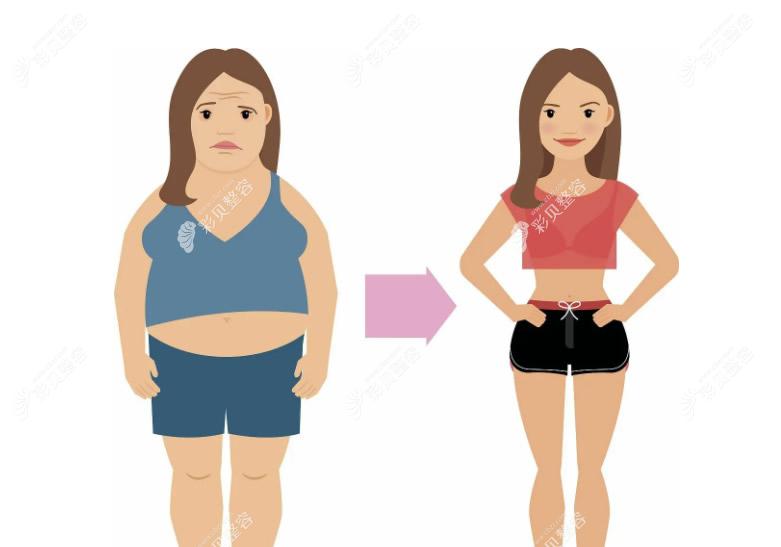 67我做了腹壁整形"后悔"死了,聊聊我做腹壁整形术个人经历