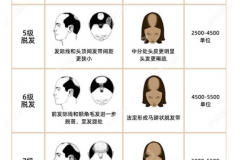 看男女头顶脱发等级划分图,研究植发五千个单位是几级脱发
