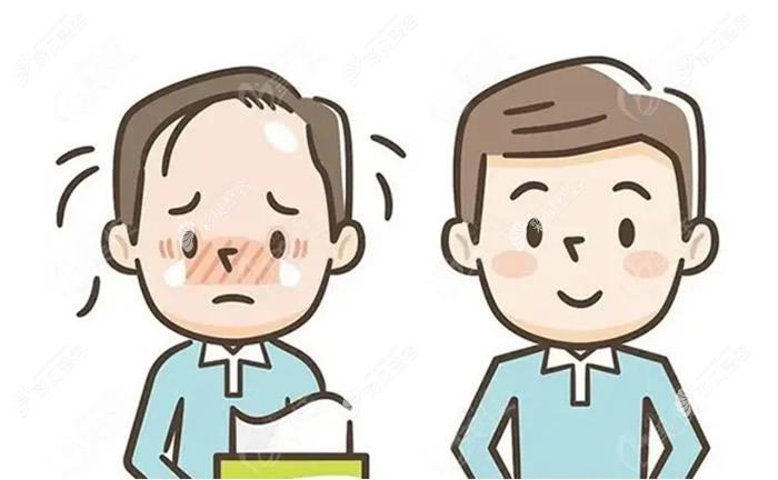 植发前后对比图片