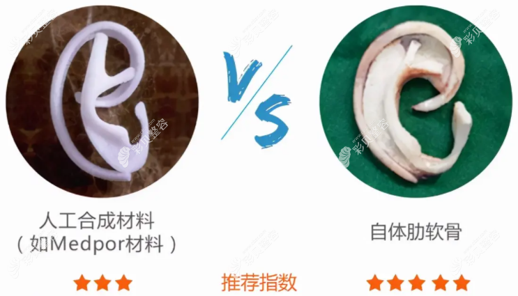 耳再造手术人工骨和自体软骨哪个好 耳再造手术人工骨和自体软骨哪个好