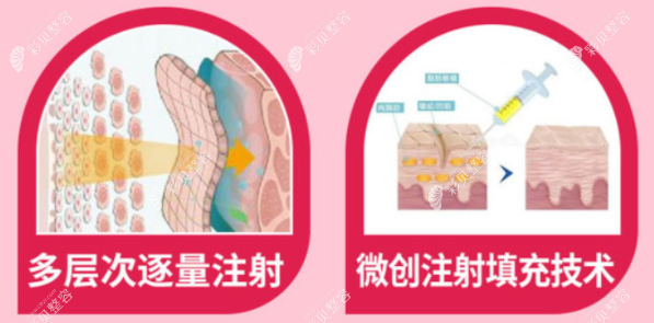 深圳美莱的郭杰医生主做什么项目可从他的个人资料来了解