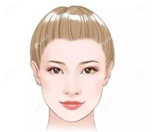 PSV面部提升术后样子示意图 PSV面部提升术后样子示意图