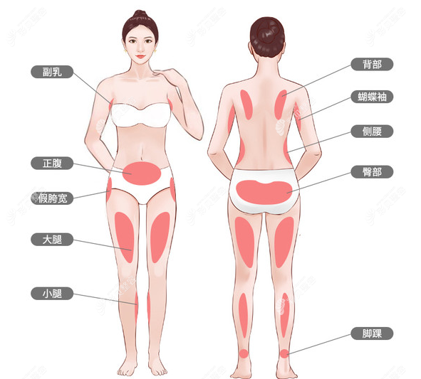 北京樱桃整形金尚训医生抽脂技术怎么样
