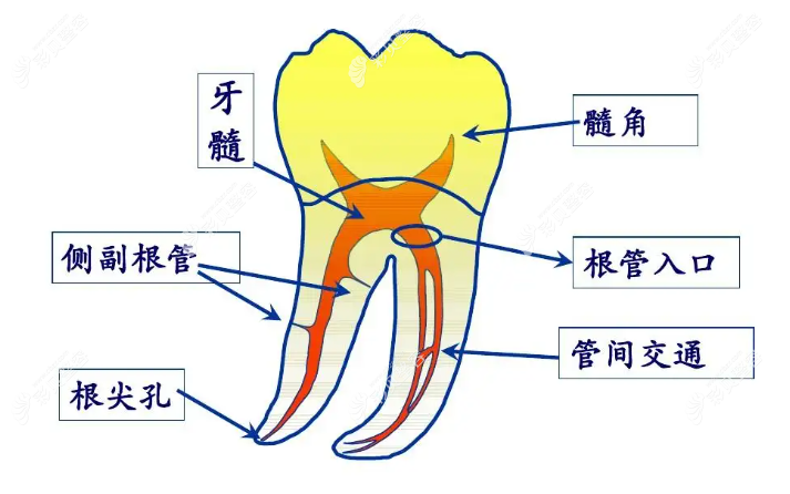 牙齿根管治疗结构图