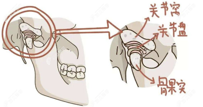 颞颌关节的构成