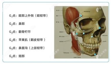 瑞蓝·丽瑅·丽多适合注射的部位