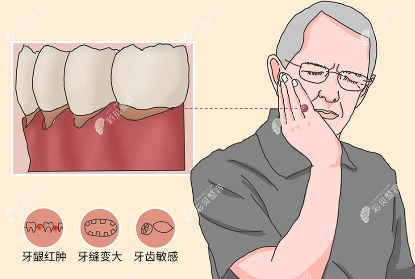 牙龈萎缩会造成哪些危害