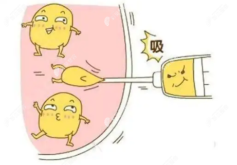 哈尔滨大腿吸脂怎么样