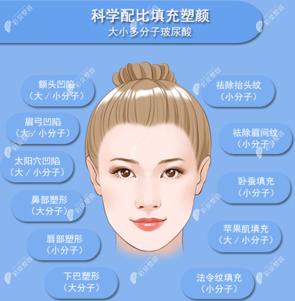 大小分子玻尿酸的填充部位