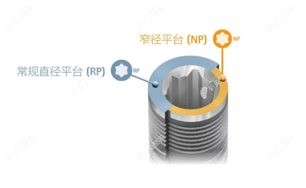 德国sky种植体平台直径区别对比图