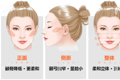 常见的颧骨问题有哪些?想要改善颧骨问题有什么方法?