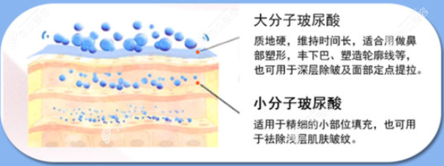 玻尿酸不同分子