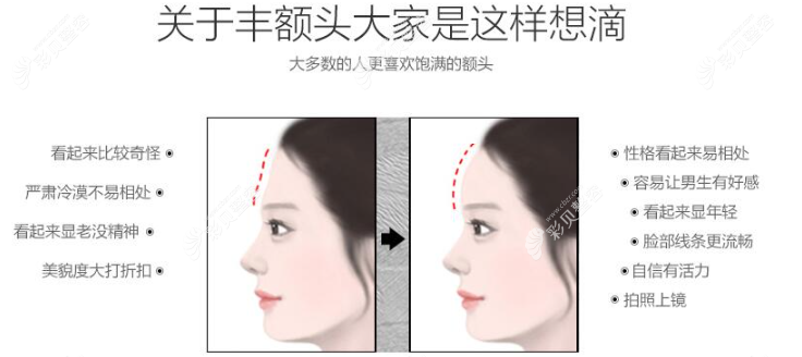 丰额头前后面部对比