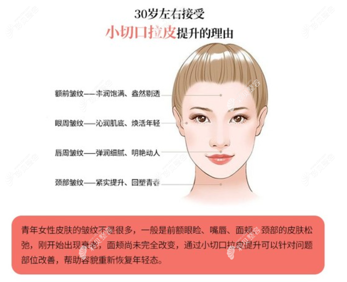 绵阳做一次拉皮手术要多少钱，面部大拉皮手术的价格公示