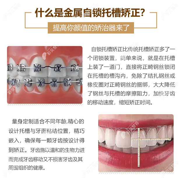 北京昌平优贝口腔技术好吗