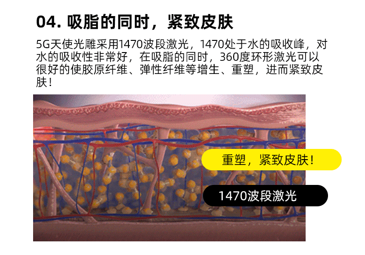 5G天使光雕