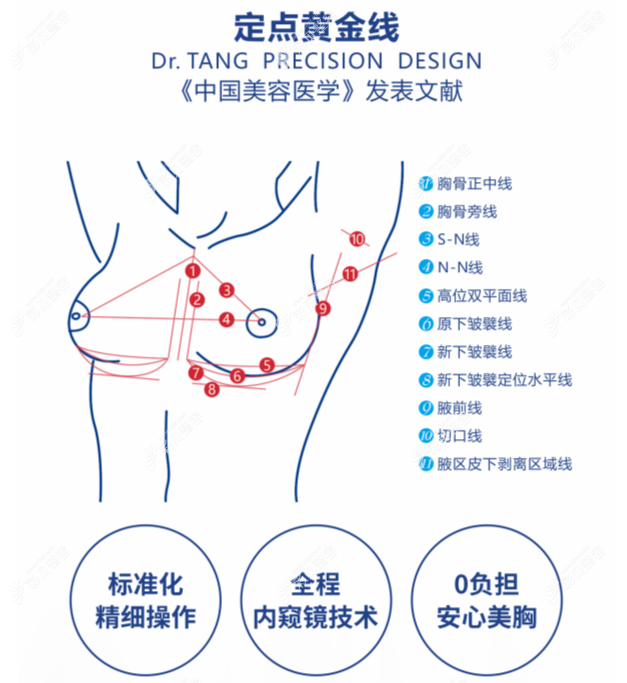 深圳富华唐新辉医生做假体隆胸好吗