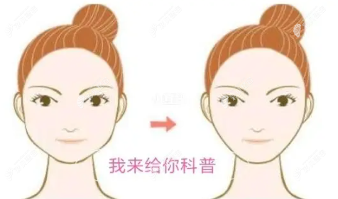 面部除皱常用的4种方法介绍,看这些面部除皱术的区别是什么