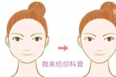 面部除皱常用的4种方法介绍,看这些面部除皱术的区别是什么