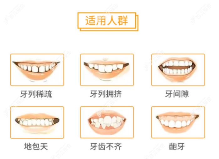 福州美橙口腔林青医生可以矫正哪些牙齿