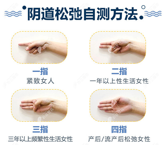 手指阴道松弛自测表