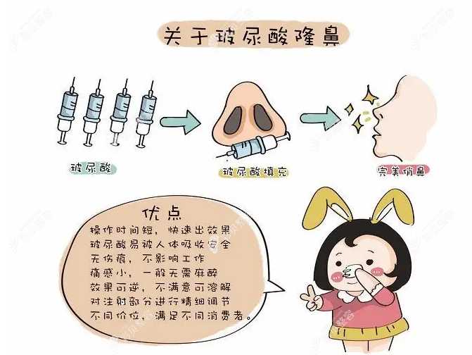邯郸注射玻尿酸隆鼻多少钱,乔雅登/伊婉等品牌价格可不同
