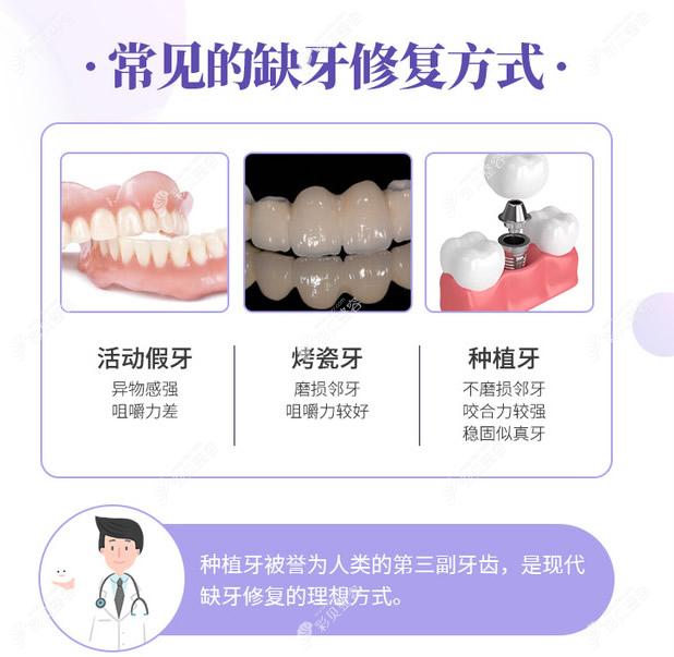 常见的缺牙修复方式有活动假牙烤瓷牙和种植牙