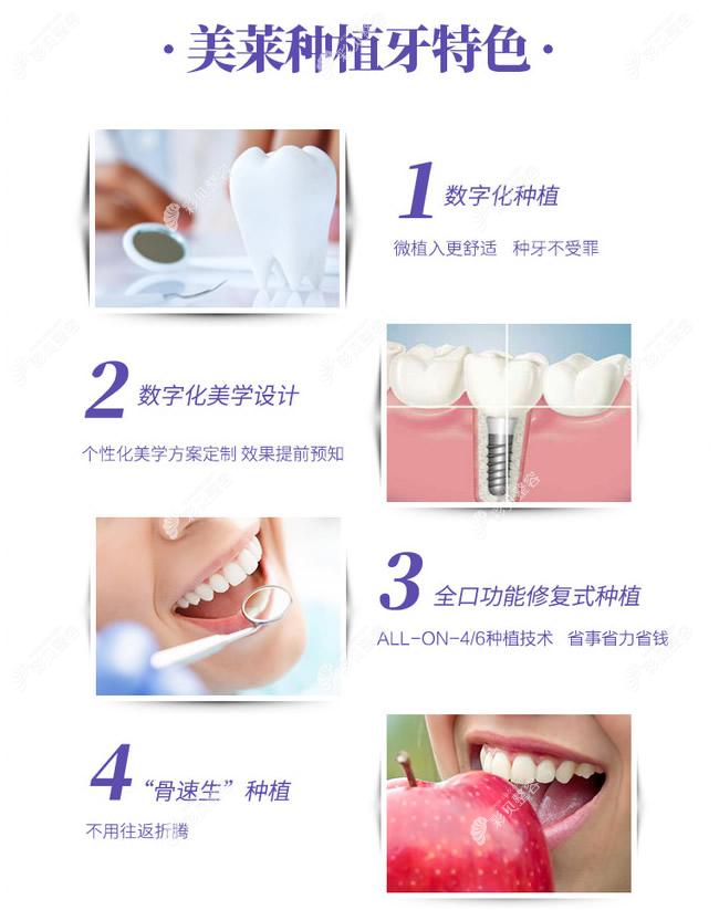 北京美莱口腔种植牙优势www.cbzr.com