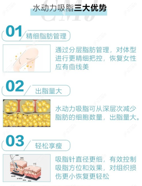 水动力吸脂的优势