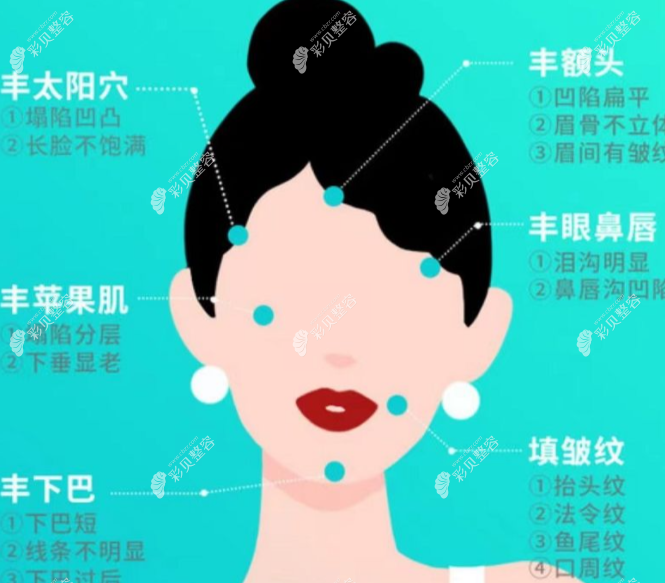 面部脂肪可以填充的部位