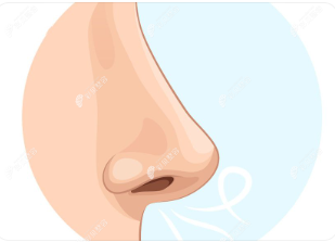 直鼻微翘cbzr.com