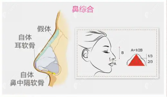 田启明医生双侧耳软骨鼻综合