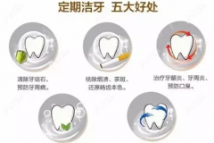 2022年上海疫情期间哪里可以洗牙，洗牙价格会不会变贵