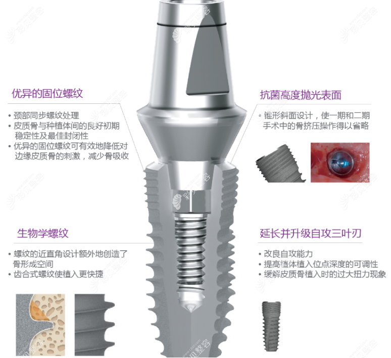 韩国登腾implantium型号种植牙