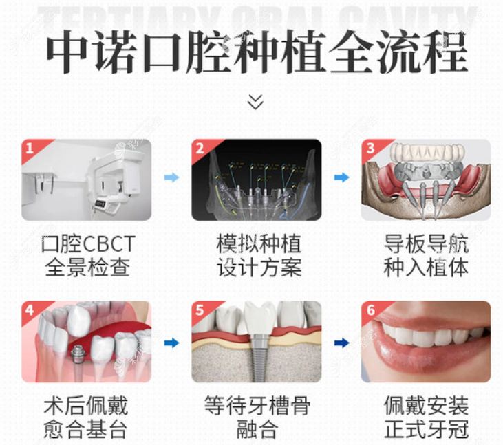 北京中诺口腔医院种植牙