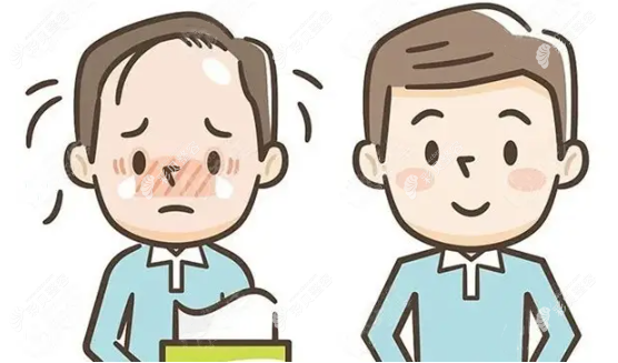 西安米兰柏羽雷惠斌医生植发怎么样