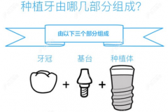 郑州植得口腔种植牙多少一颗，从郑州植得口腔价格表看