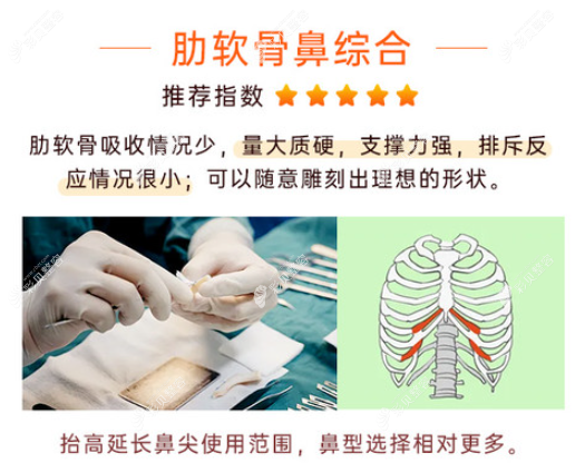 肋软骨隆鼻的优势 肋软骨隆鼻的优势