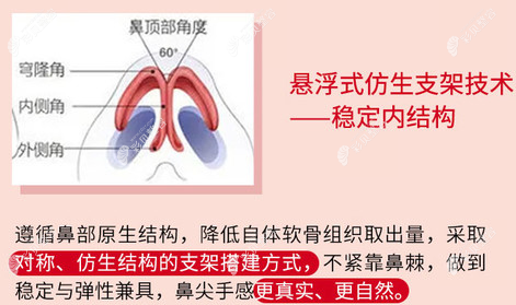 唐向东隆鼻手术方式 唐向东隆鼻手术方式